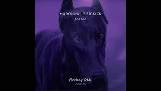Madonna Vs Sickick - Frozen Fireboy DML Remix