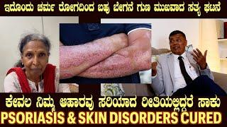 Live Story of PSORIASIS cured by Food as Medicine by Dr S M Raju IAS Rtd