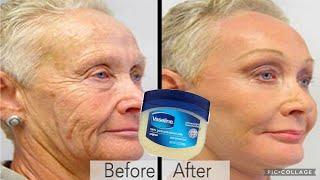 Vaseline and Baby oil make your skin young and moisturize. #dermatologist #skinadvice #skincare