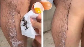 Stop shaving heres how to permanently get rid of facial and body hair  Unwanted hair removal