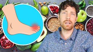 Vegan Diet vs Gout Home Remedy?