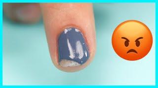 PREVENT UGLY Chipped Nails  Suzie’s Pro Education