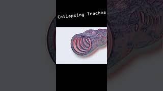 Collapsing Trachea in dogs #shorts