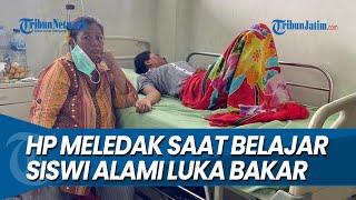 HP MELEDAK SAAT DIPAKAI BELAJAR Siswi SMKN di Ponorogo Alami Luka Bakar