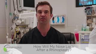 How Will My Nose Look after a Rhinoplasty?