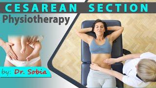 Cesarean Section Physiotherapy  Dr. Sobia