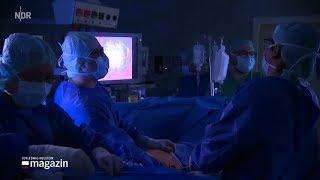 First subxiphoid resection in Germany during live surgery NDR TV