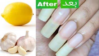 How To Grow Nails Naturally With Proven Nails Growth Remedies   وصفة تطويل الاظافر السريعة جداا