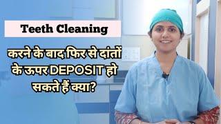 Teeth Cleaning होने के बाद भी दातों के ऊपर deposit हो सकते हैं क्या?