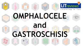 Omphalocele and Gastroschisis