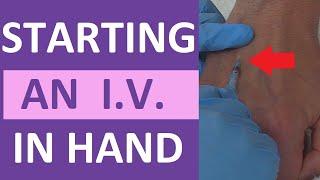 How to Start an IV  IV Catheter Insertion & Flush Technique in Hand  Nursing Skill