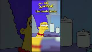 Lisa needs braces  The Simpsons #shorts