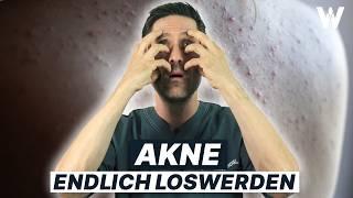 Akne X dauerhaft loswerden Die besten Tipps für reine Haut dermatologisch getestet