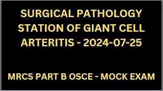 SURGICAL PATHOLOGY STATION OF GIANT CELL ARTERITIS