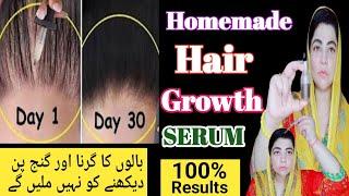 DIY Overnight Hair Re-growth Serum  powerful Homemade Serum For extreme hair growth  diy serum