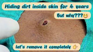 OMG....What came out from the skin????