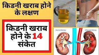 किडनी खराब होने के लक्षण  Kidney Kharab Hone Ke Lakshan  SELF DOCTOR