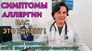 Симптомы аллергии о которых вы не знали. Врач аллерголог иммунолог Екатерина Цывкина