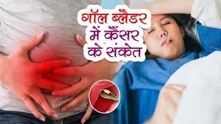 Gallbladder cancer होने पर शरीर में दिखते हैं ये  लक्षण I Gall bladder Cancer treatment in Delhi