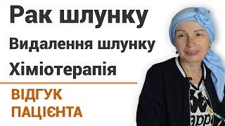 Рак желудка удаление желудка и химиотерапия - отзыв пациентки онкоцентра Добрый прогноз