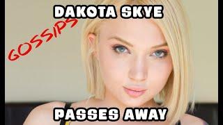 Dakota Skye passes away