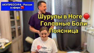 Шурупы в Ноге  Головные Боли  Крестец  в «АКУПРЕССУРА - Россия» в эфире #акупрессурароссия