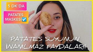 PATATES SUYU MASKESİ  PATATES SUYU İLE CİLT BEYAZLATMA  PATATES MASKESİ  GÖZ ALTI MORLUKLARI