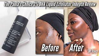 PAULAS CHOICE SKIN PERFECTING 2% BHA LIQUID EXFOLIATOR INDEPTH REVIEW + how to use & how to layer