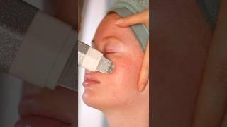 Sensitive Skin Treatment Customized facials for your unique skin. New episode this week 