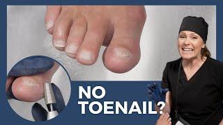 Dry Pedicure with NO TOENAIL - Cuticle Care Nail Trimming Callus Exfoliation