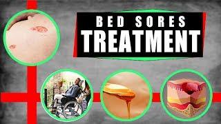 Bed Sores Treatment How to Treat Bed Sores at Home – Top 5 Remedies for Bed Sores
