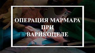 Операция при варикоцеле по методу Мармара