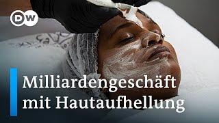 Warum bleichen Millionen Menschen ihre Haut?  DW Nachrichten