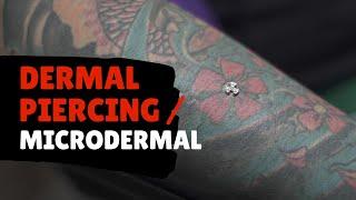 Dermal Piercing Microdermal - Body Piercing - Proses Cara Tindik