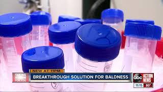 California lab creating cure for baldness using cell cloning process