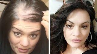 How To Hide Thin-balding Head With Hair Topper  UniWigs