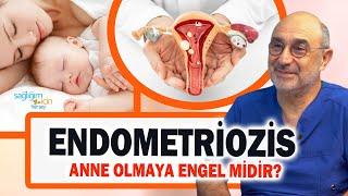 Çikolata Kisti Endometriozis Anne Olmaya Engel midir?