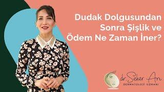 Dudak Dolgusundan Sonra Şişlik ve Ödem Ne Zaman İner?