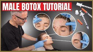 Botox Tutorial For Men  Botox Injection Patterns  Forehead Corrugators & Crows Feet