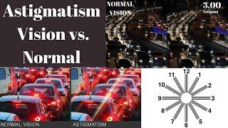 Astigmatism Vision vs normal Astigmatism Symptoms What is astigmatism