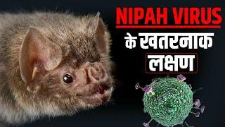 Nipah Virus Symptoms ये हैं इस Virus के खतरनाक लक्षण  Kerala Government