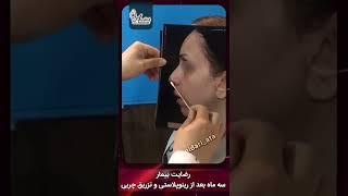 جراحی زیبایی بینی و تزریق چربی به صورت