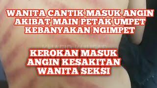 Kerokan masuk angin kesakitan wanita cantik seksi