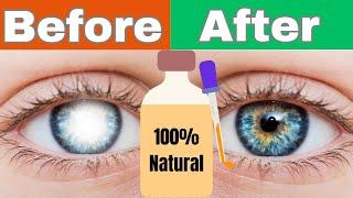 #1 Remedy For Cataracts 100% Natural