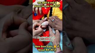 New Born Baby में Blood sample कैसे ले  छोटे बच्चों में Blood Sample कैसे निकाले in one  month baby