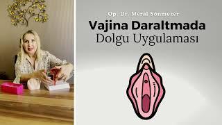 Vajina Daraltmada Dolgu Uygulamaları