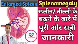 Splenomegaly। Speen प्लीहा तील्ली के बारे में पूरी जानकारी। CausesTypesTreatment Of Splenomgaly