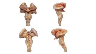 Mesencephalon Midbrain ENG