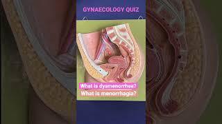 Can you answer this ?  #mbbs #anatomy #periods #women