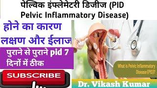 PID Pelvic Inflammatory Diseases Causes Symptoms and Treatment by Dr. Vikash Sir